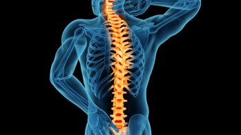 642x361-Treating_Spinal_Stenosis-Exercise_Surgery_and_More